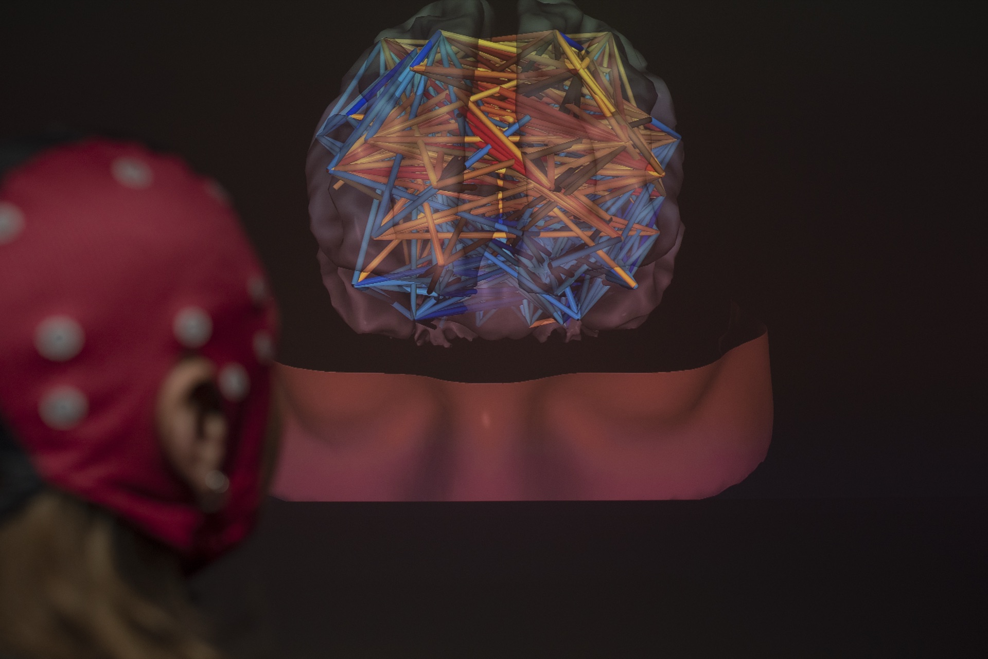 Brain Mapping qEEG · Veruvis®